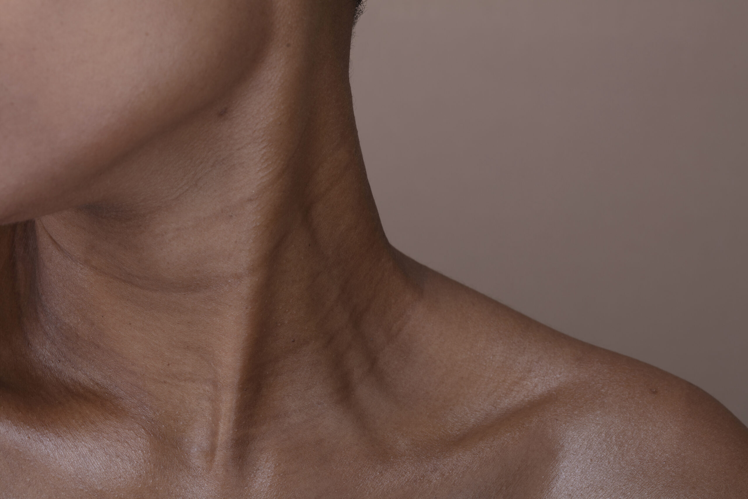 Close-up of a person's neck and collarbone after non-surgical neck lift at Couture Dermatology