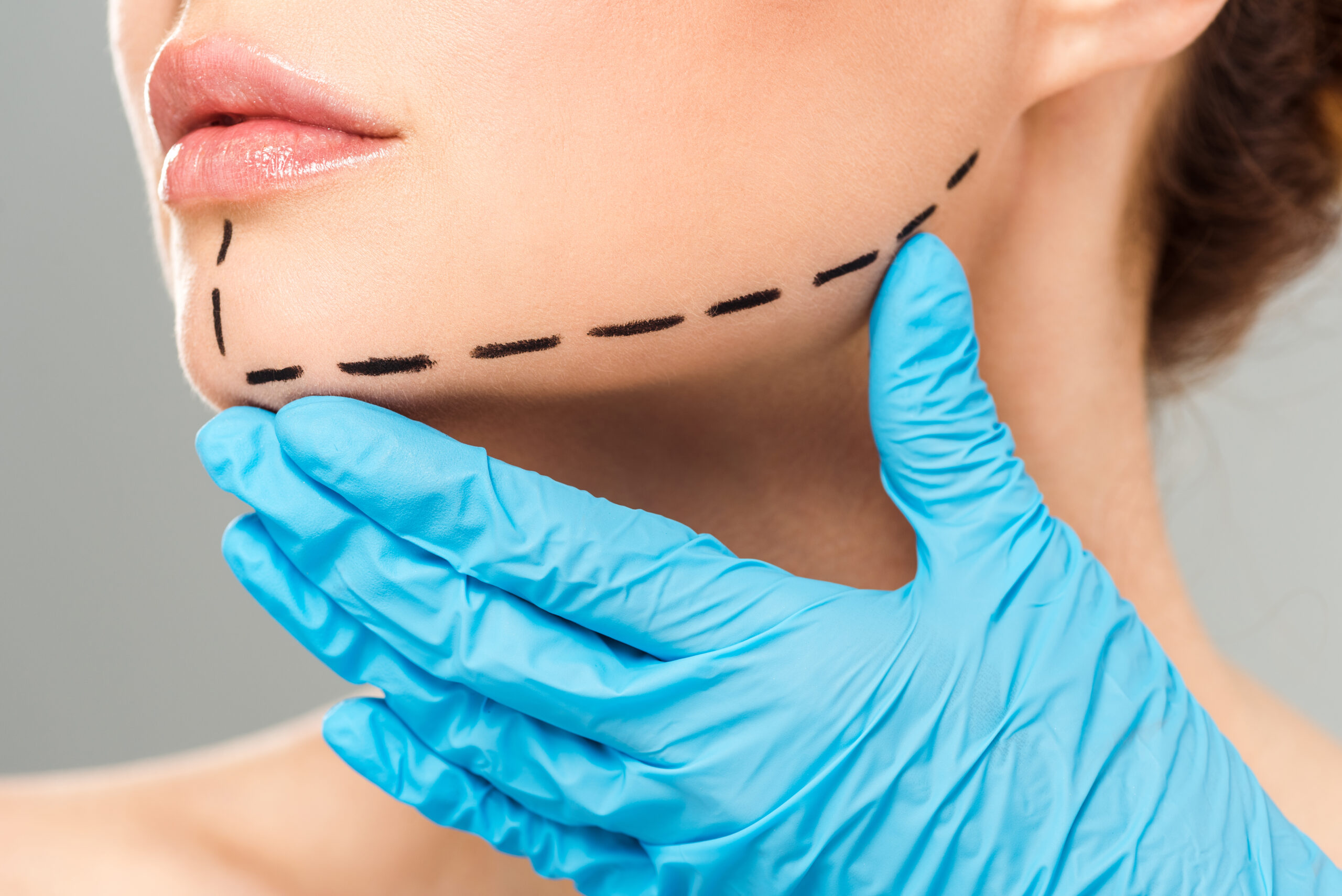 Board-certified dermatologist assessing jawline for contouring filler Beverly Hills