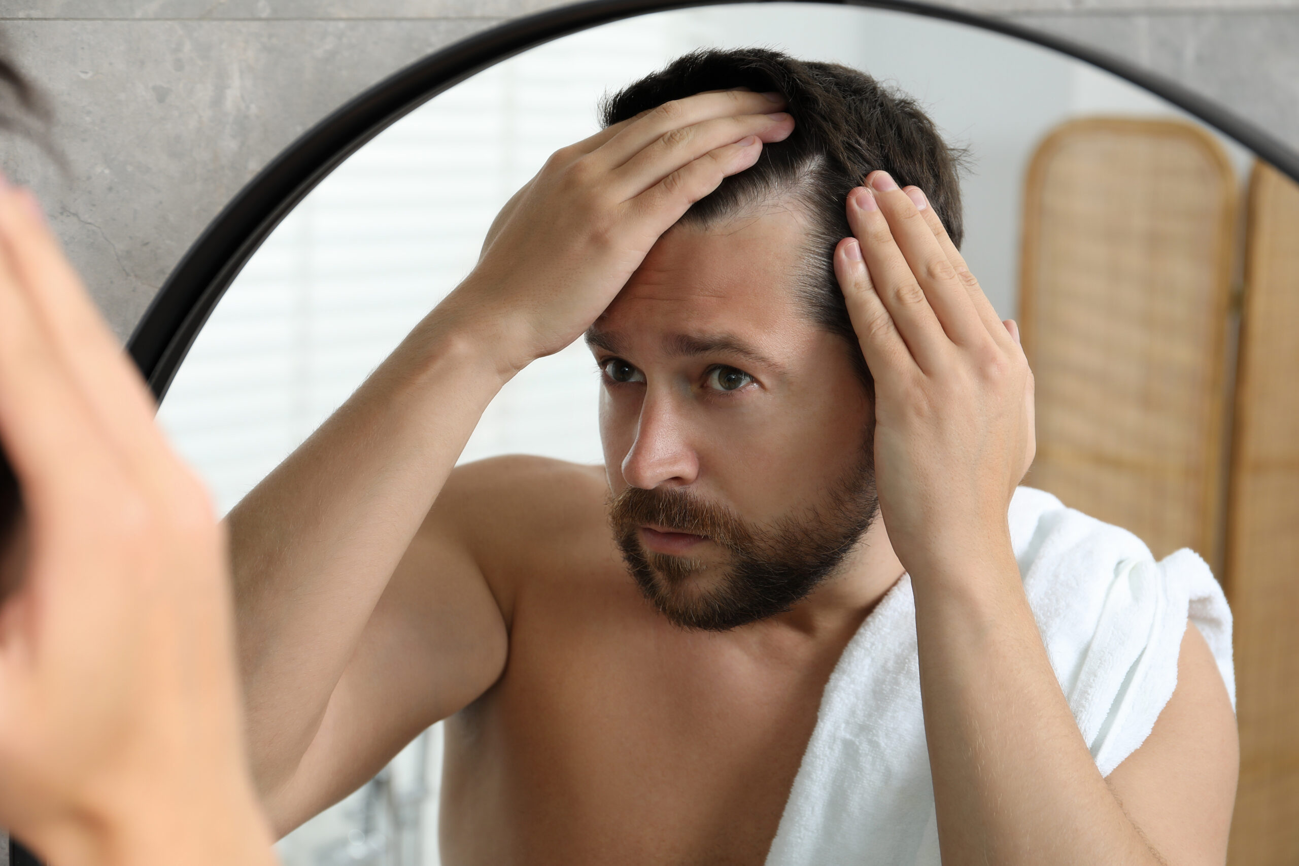Man examining hair loss in mirror at Couture Dermatology and Laser Beverly Hills