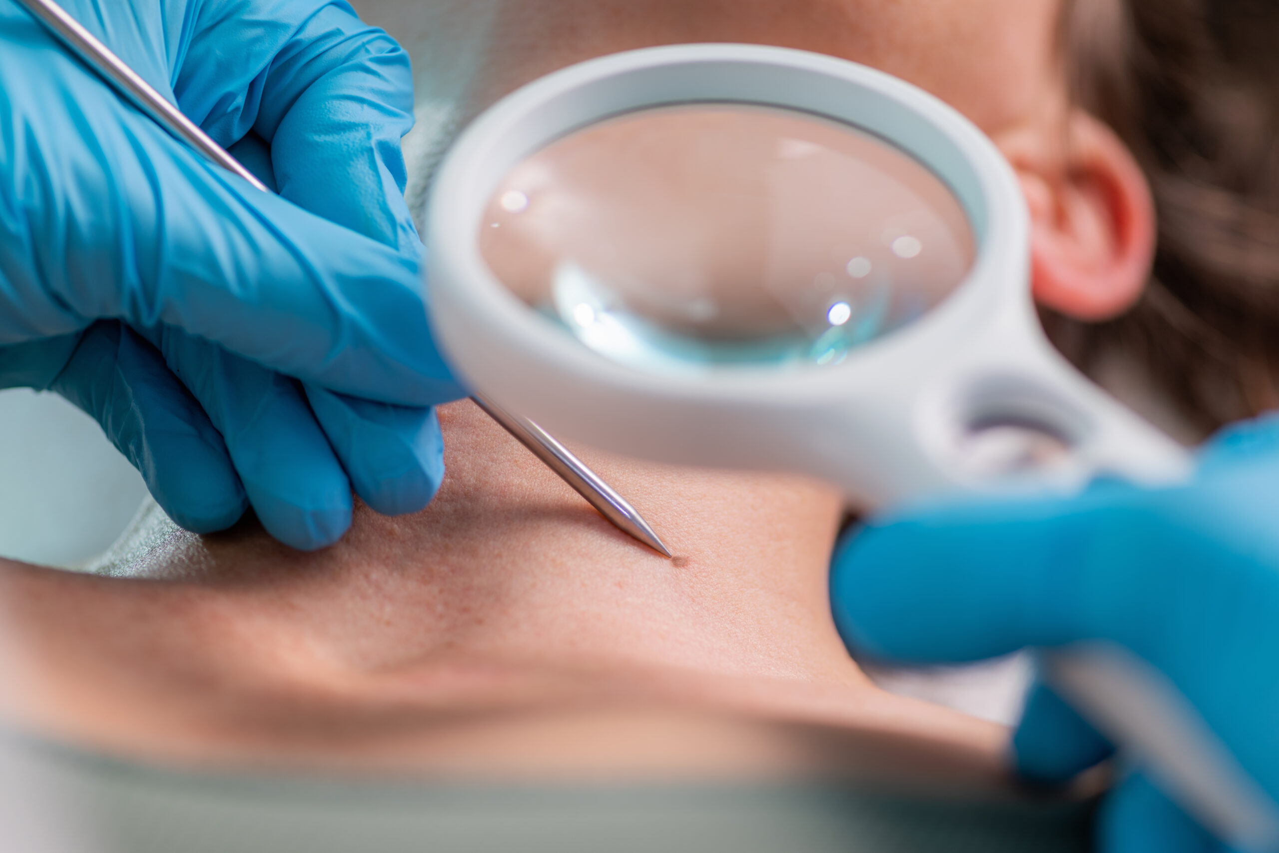 Dermatological procedure at Couture Dermatology and Laser Beverly Hills