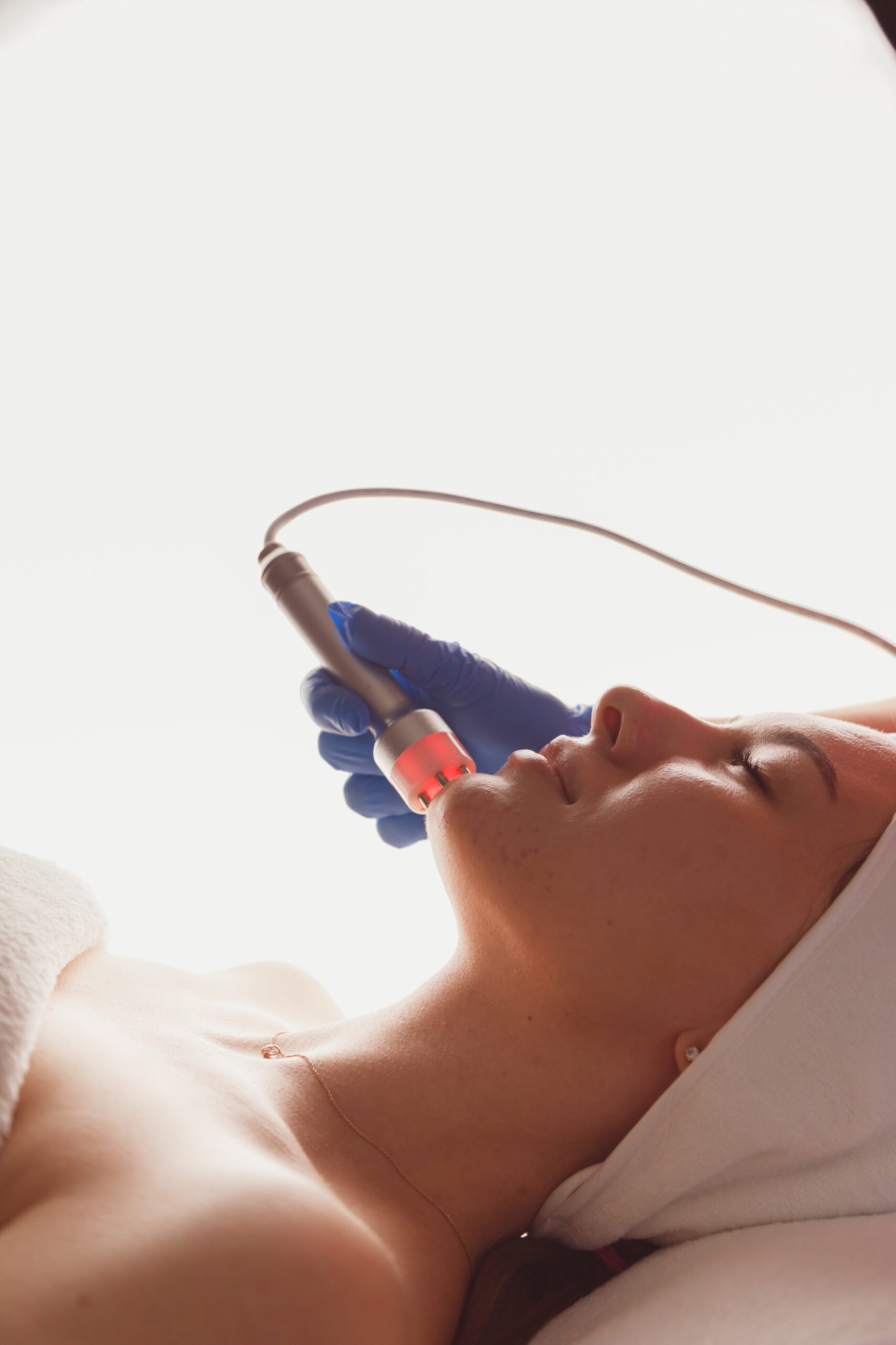 Laser skin resurfacing treatment at Couture Dermatology and Laser Beverly Hills