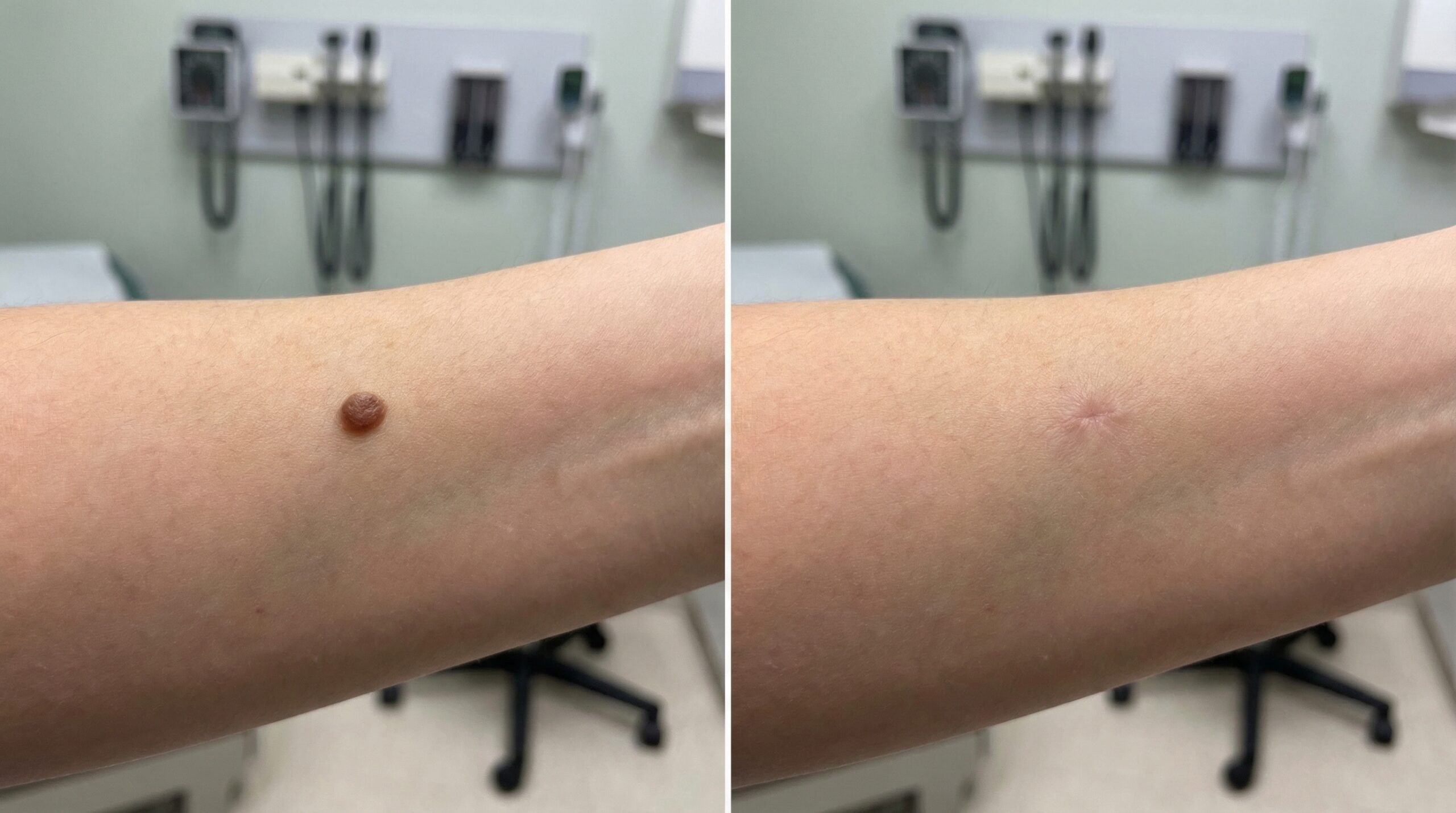 Full Body Skin Exam results at Couture Dermatology and Laser Beverly Hills